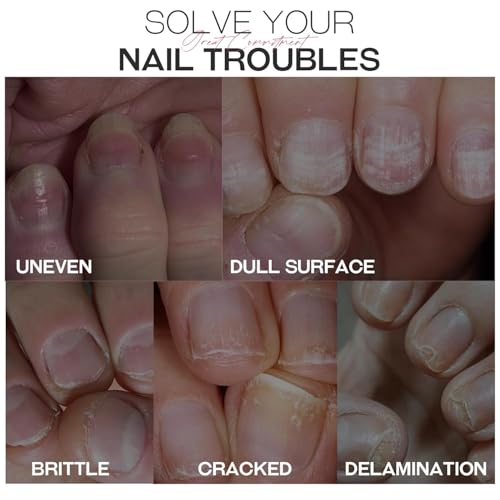Fortalecedor de uñas y endurecedor de crecimiento: tratamien