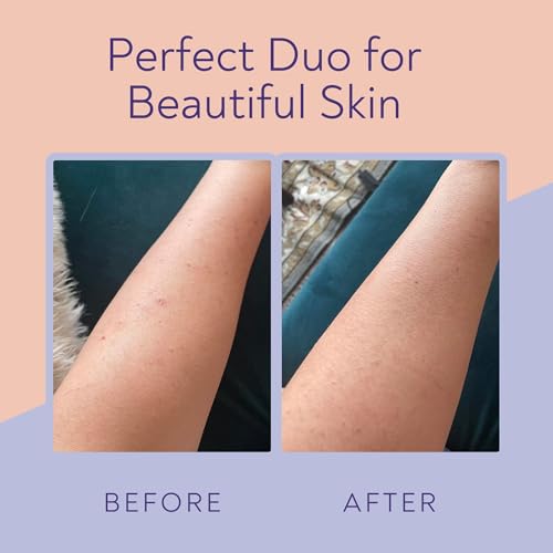KP Bump Eraser Body Scrub & Keratosis Pilaris Lotion Set – T