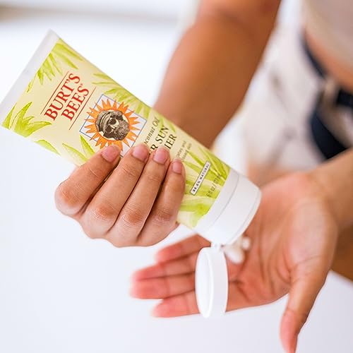 Calmante para después del sol con aloe y tilo, 6 onzas, Burt