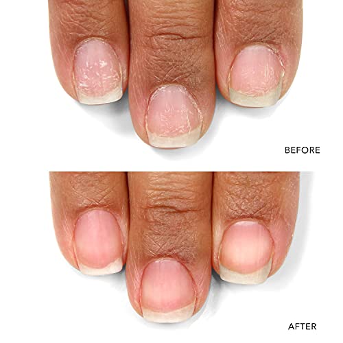LONDONTOWN kur - Probiótico de uñas Instant Boost, mascarill