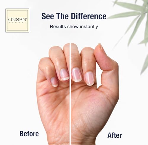 Onsen Tratamiento en crema de uñas y cutículas con aceite de