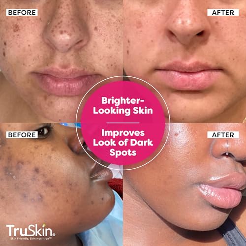 TruSkin Vitamin C-Plus Super Serum - Suero facial antiarruga