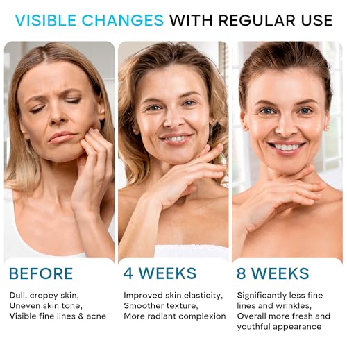 Crema de retinol para la cara, hidratante facial con ácido h