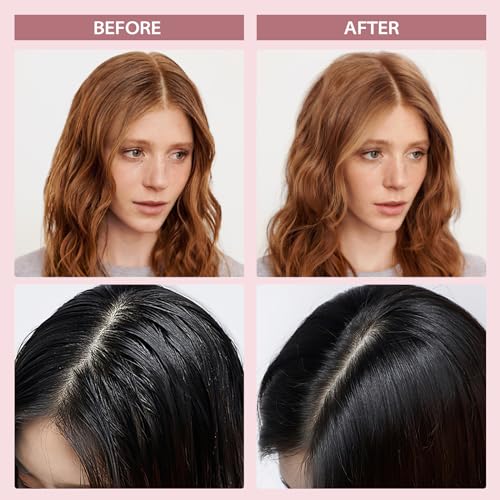 YLNALO Champú seco en polvo, paquete de 2 unidades, cabello