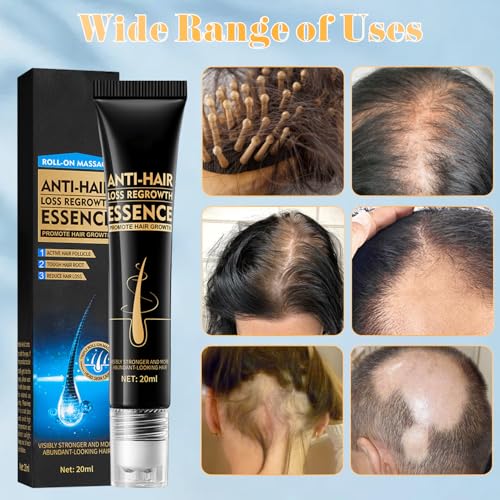 Zozu - Esencia de crecimiento del cabello, 2 unidades, anti