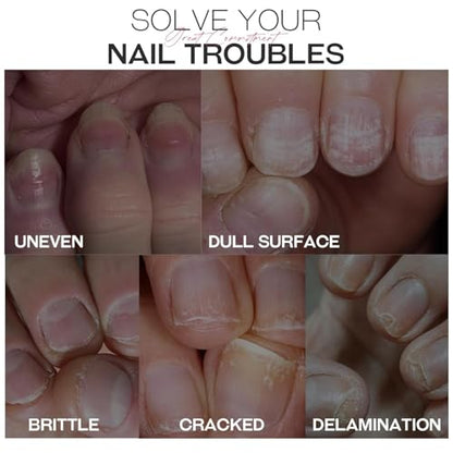 Fortalecedor de uñas y endurecedor de crecimiento: tratamien