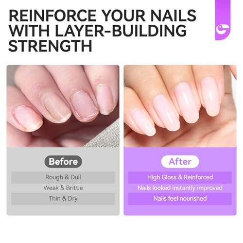 Gelike EC Nail Ridge Filler: Tratamiento natural para el cre
