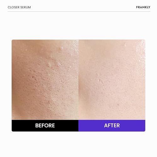 FRANKLY Closer Serum | Suero minimizador de poros | 9 péptid