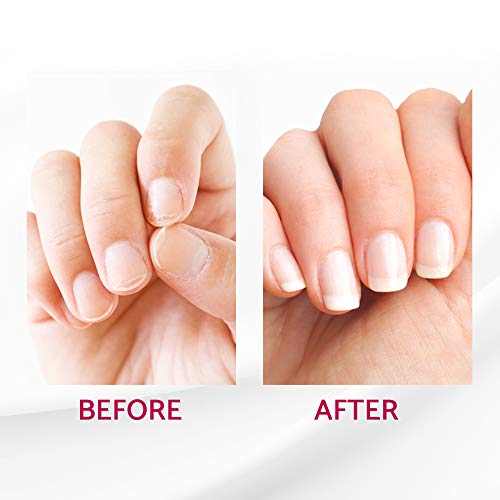 IBD Reconstrux - Tratamiento de reparación de uñas – Fortale