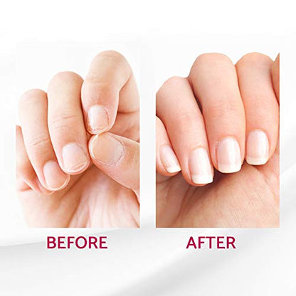 IBD Reconstrux - Tratamiento de reparación de uñas – Fortale