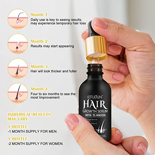 Suero de crecimiento del cabello de minoxidil al 5 % para ho