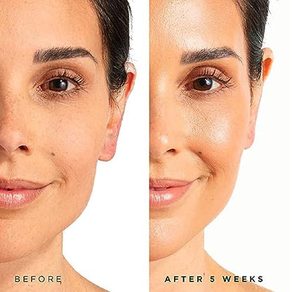 Tree of Life Beauty Suero facial hidratante – Péptidos de co